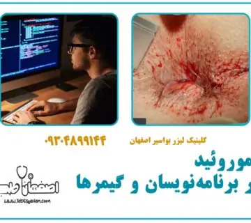 هموروئید در برنامه‌نویسان و گیمرها