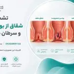 تشخیص شقاق از بواسیر و سرطان مقعد: راهنمای جامع (نشانه‌های قرمز)