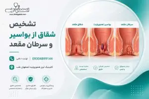تشخیص شقاق از بواسیر و سرطان مقعد: راهنمای جامع (نشانه‌های قرمز)