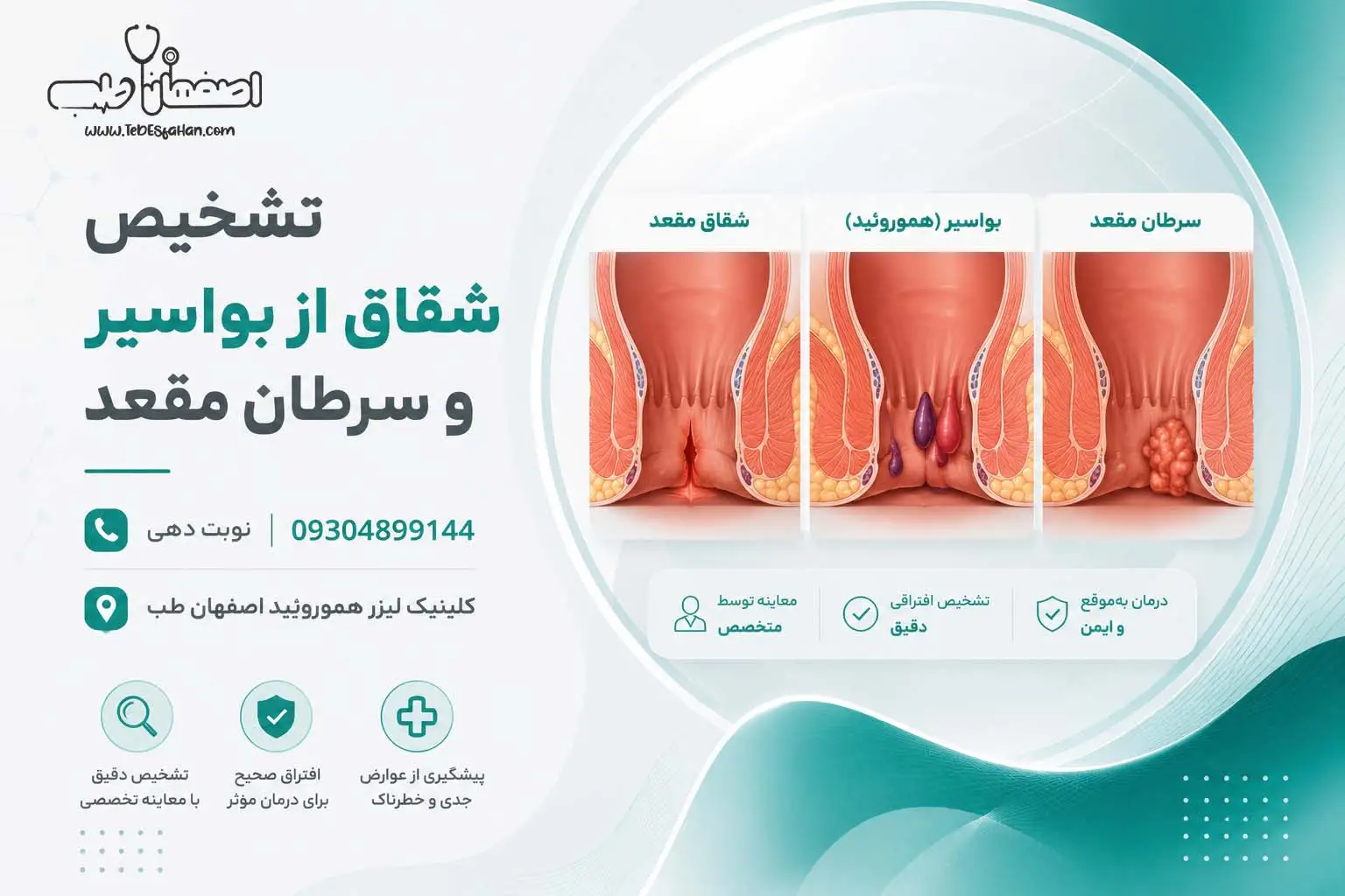 تشخیص شقاق از بواسیر و سرطان مقعد: راهنمای جامع (نشانههای قرمز)