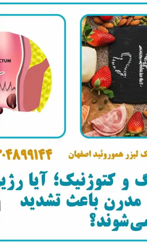 رژیم فستینگ و کتوژنیک؛ آیا رژیم‌های لاغری مدرن باعث تشدید هموروئید می‌شوند؟