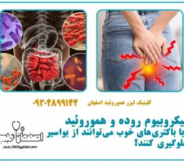 میکروبیوم روده و هموروئید: آیا باکتری‌های خوب می‌توانند از بواسیر جلوگیری کنند؟